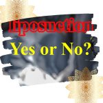 Liposuction: Yes or No?